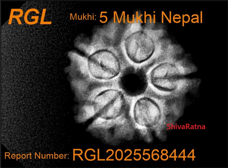 5mukhi xray report by shivaratna